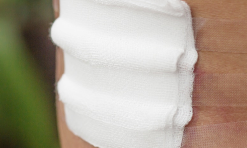 Blog-Wound-Poor-Blood-Flow