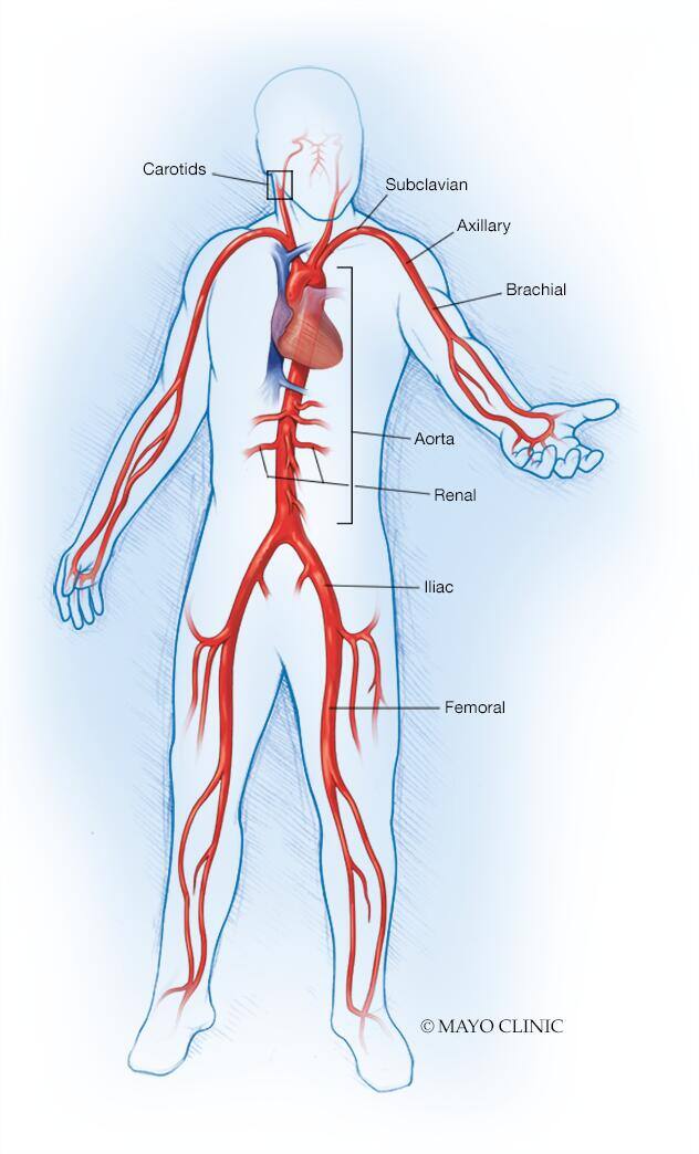 Large arteries