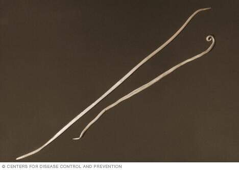 Image of an ascariasis worm