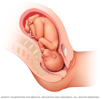 Fetus 38 weeks after conception