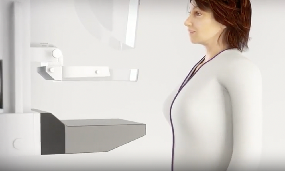 Video-Mammogram